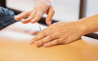 Dry Needling for Sciatica: How Revolution Rehab Can Help You Beat That Annoying Pain