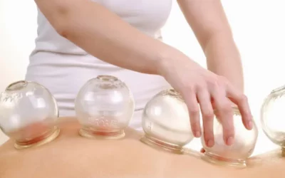 The Dangers of Cupping: What You Need to Know Before You Try It