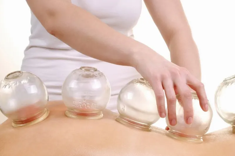 The Dangers of Cupping